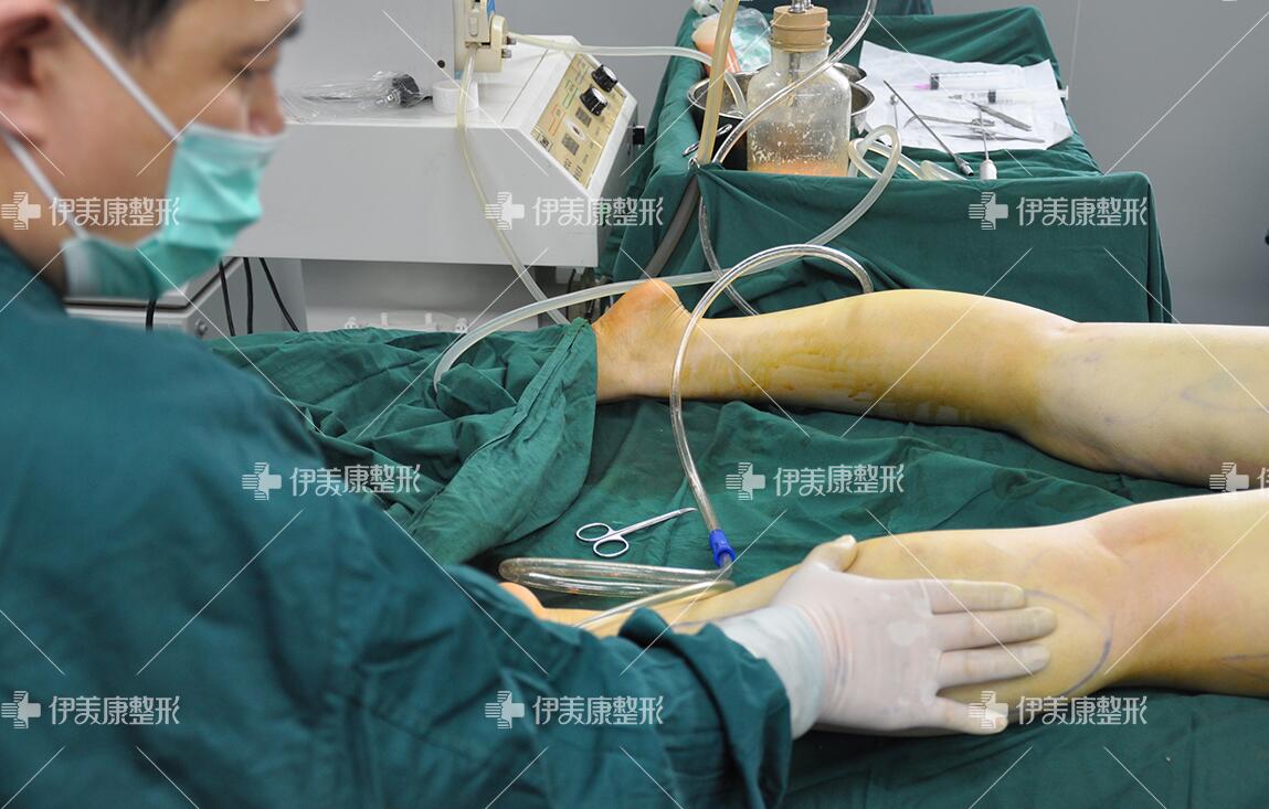 做手术抽脂_手术抽脂价格一览表_手术抽脂价格