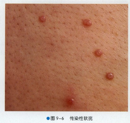 连老鼠都不曾见过,更不要说老鼠的乳头了,请看下图:本性:是一种病毒性