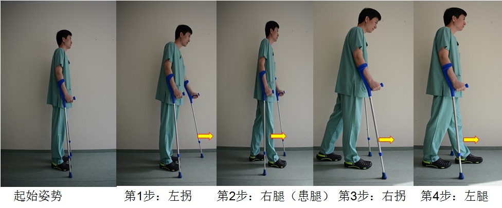 您知道肘拐(杖)吗?_邢剑_主管康复技师_爱问健康