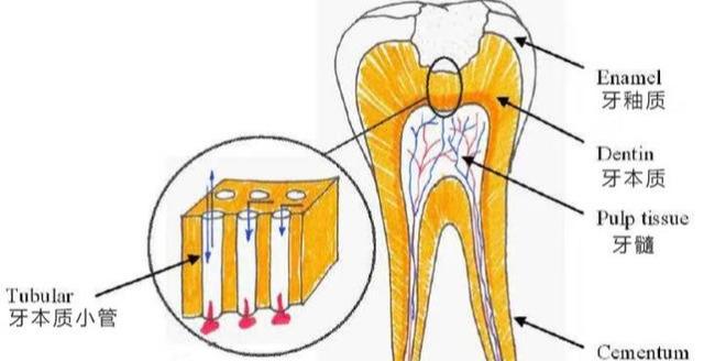 牙本质小管暴露图片