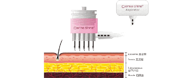 立肤保怎么用看完这一篇,关于“肌肤保湿”的难题立马解开_https://www.jmylbn.com_新闻资讯_第10张