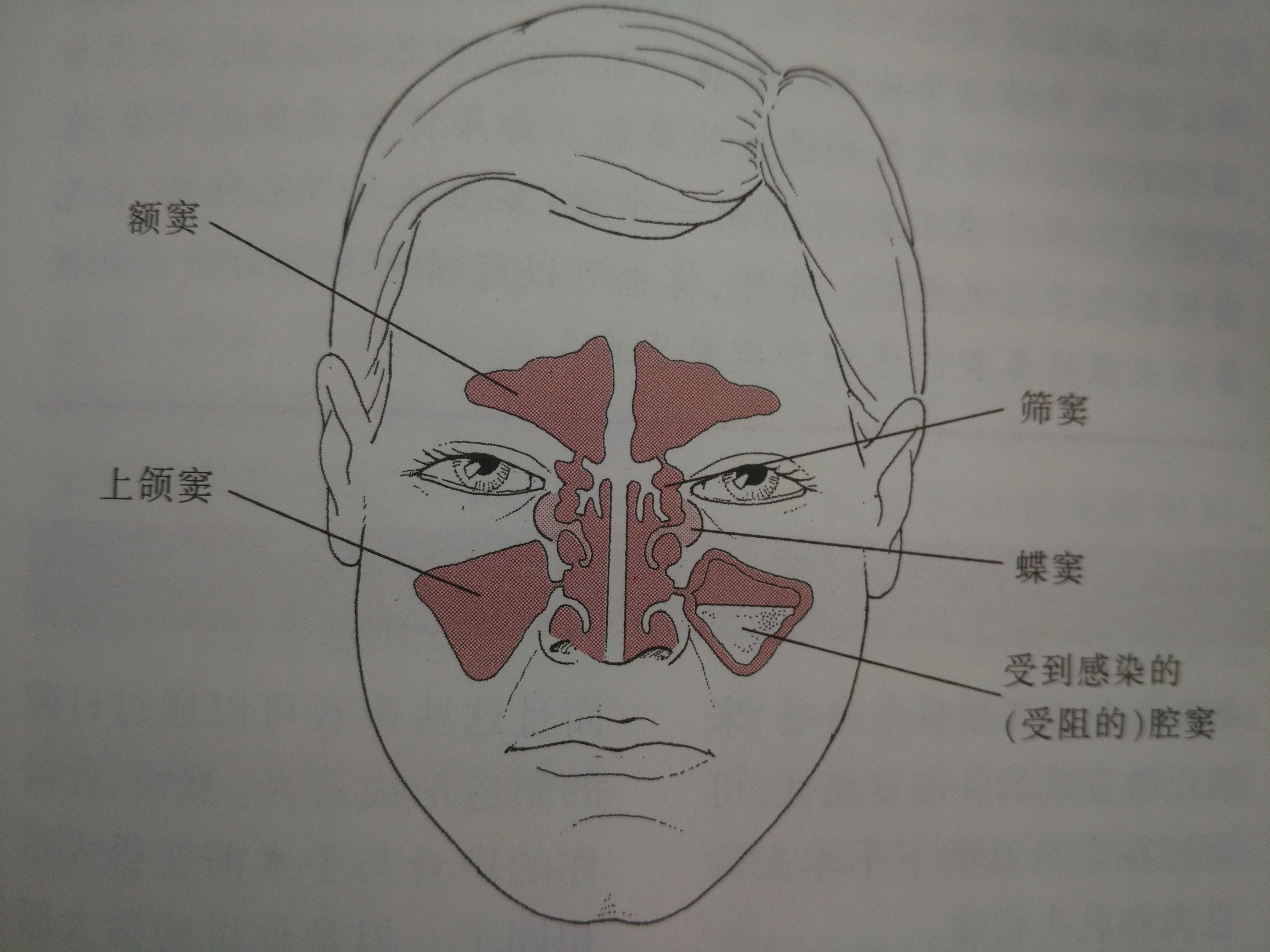 蝶窦位置图片图片