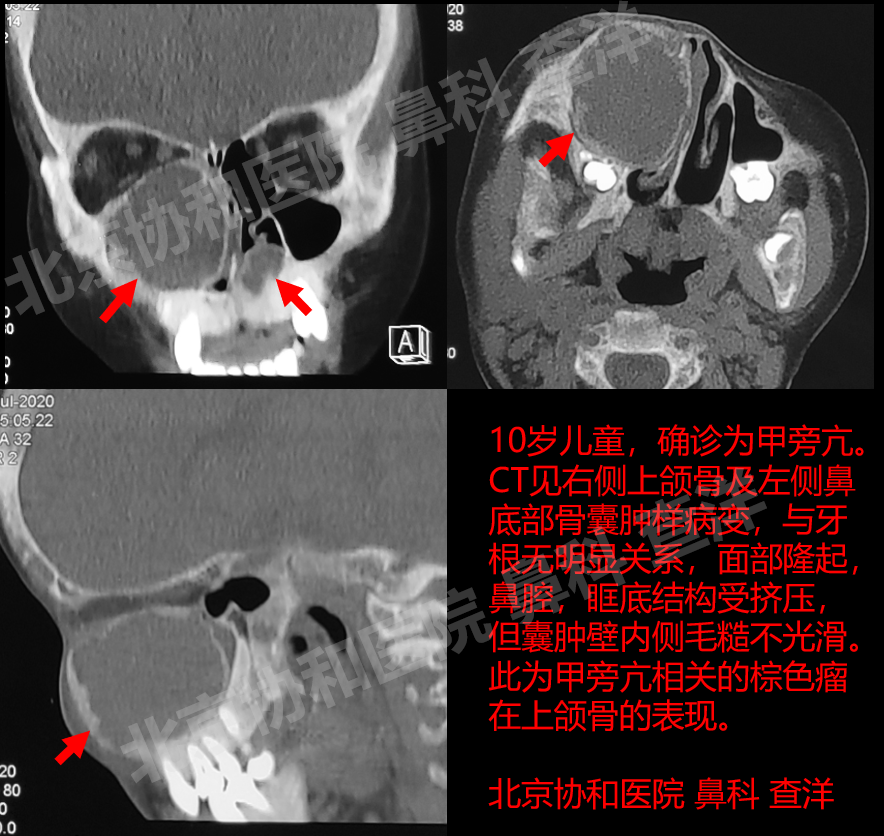 病例回顾