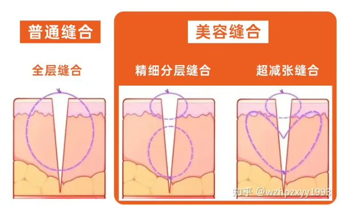 事发温州！一家长深夜驱车3小时，只为孩子这件事