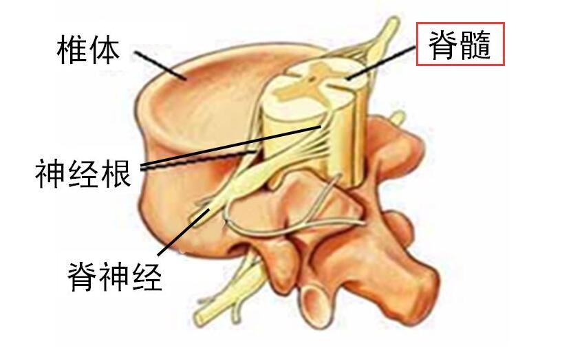 颈椎病导致脊髓受压严重吗?该怎么办?