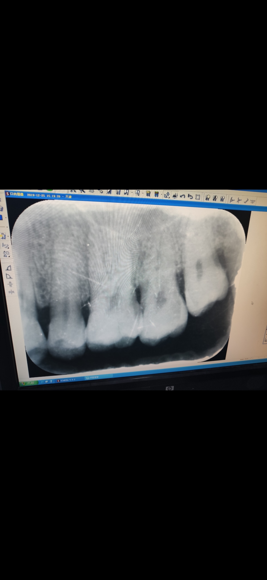 曲面断层片怎么看牙科影像学检查和作用（孕期能否拍摄？）_https://www.jmylbn.com_新闻资讯_第1张