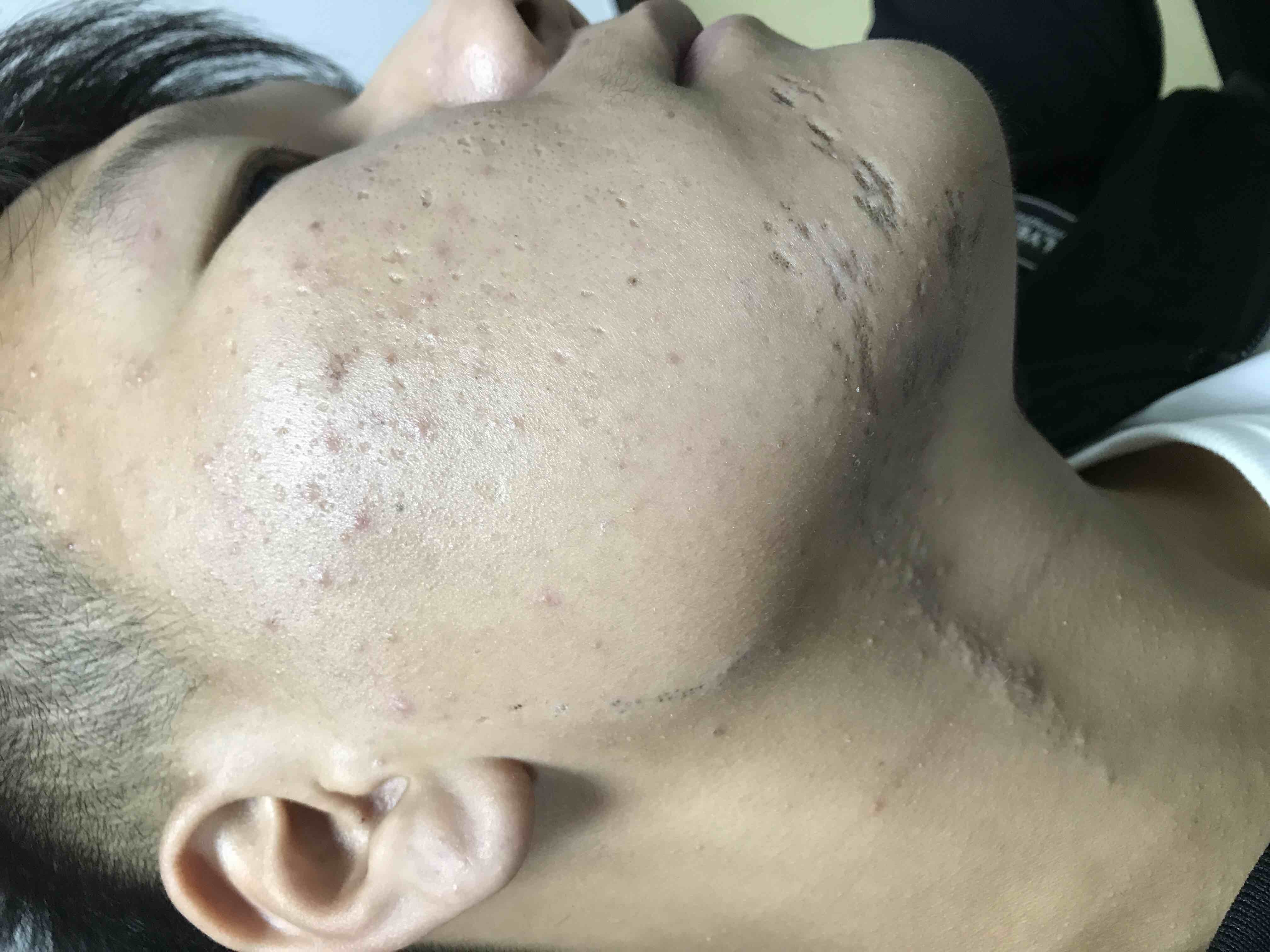 һĺͷ۴