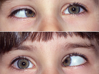 保护眼睛从小做起