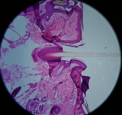下面两张图,就是皮肤毛囊的切片:毛囊的主要功能就是合成人体的毛发.