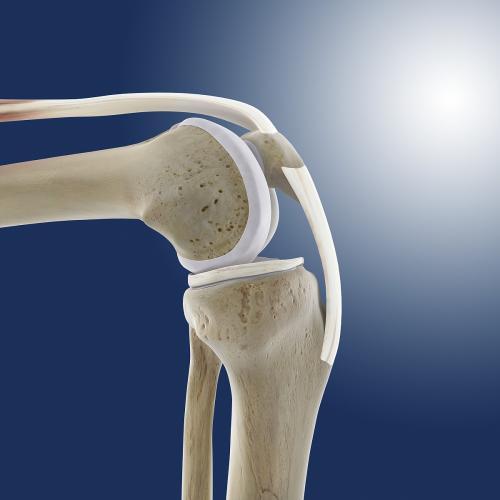 可调膝关节支具怎么用膝关节手术后支具要戴多久？睡觉也要戴吗？几个月才能脱下支具？_https://www.jmylbn.com_新闻资讯_第2张