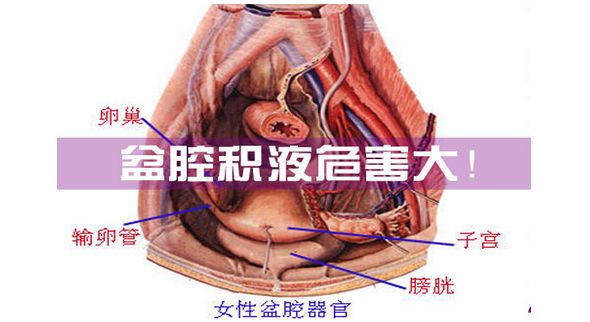 关于盆腔积液的问题