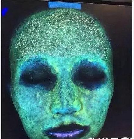 面膜不能乱敷,否则事得其反