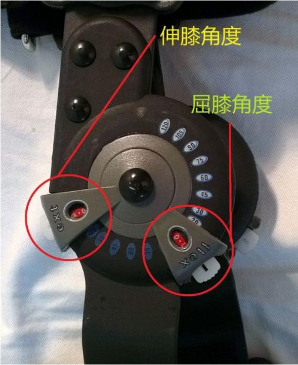 可调膝关节支具怎么用膝关节手术后支具要戴多久？睡觉也要戴吗？几个月才能脱下支具？_https://www.jmylbn.com_新闻资讯_第4张