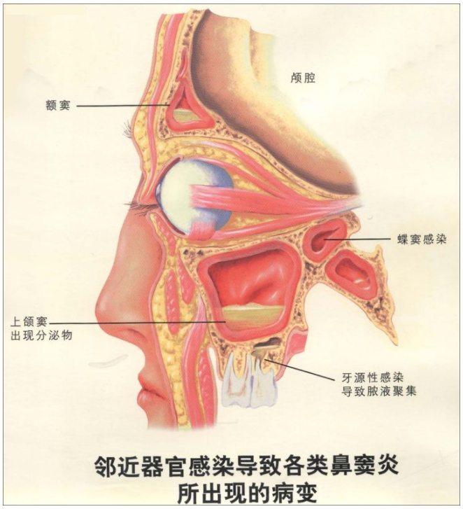 鼻黏膜位置图图片