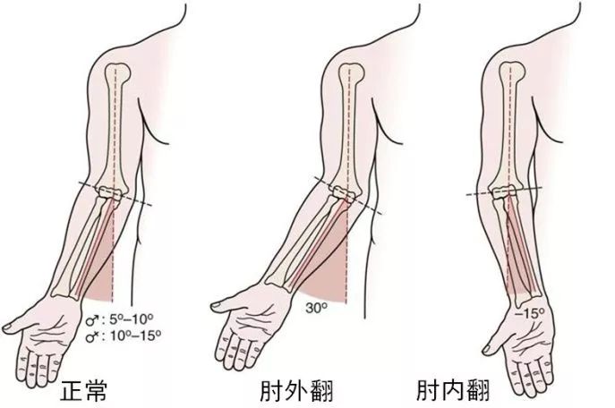 正常范围在10~15度,我们称为"提携角"