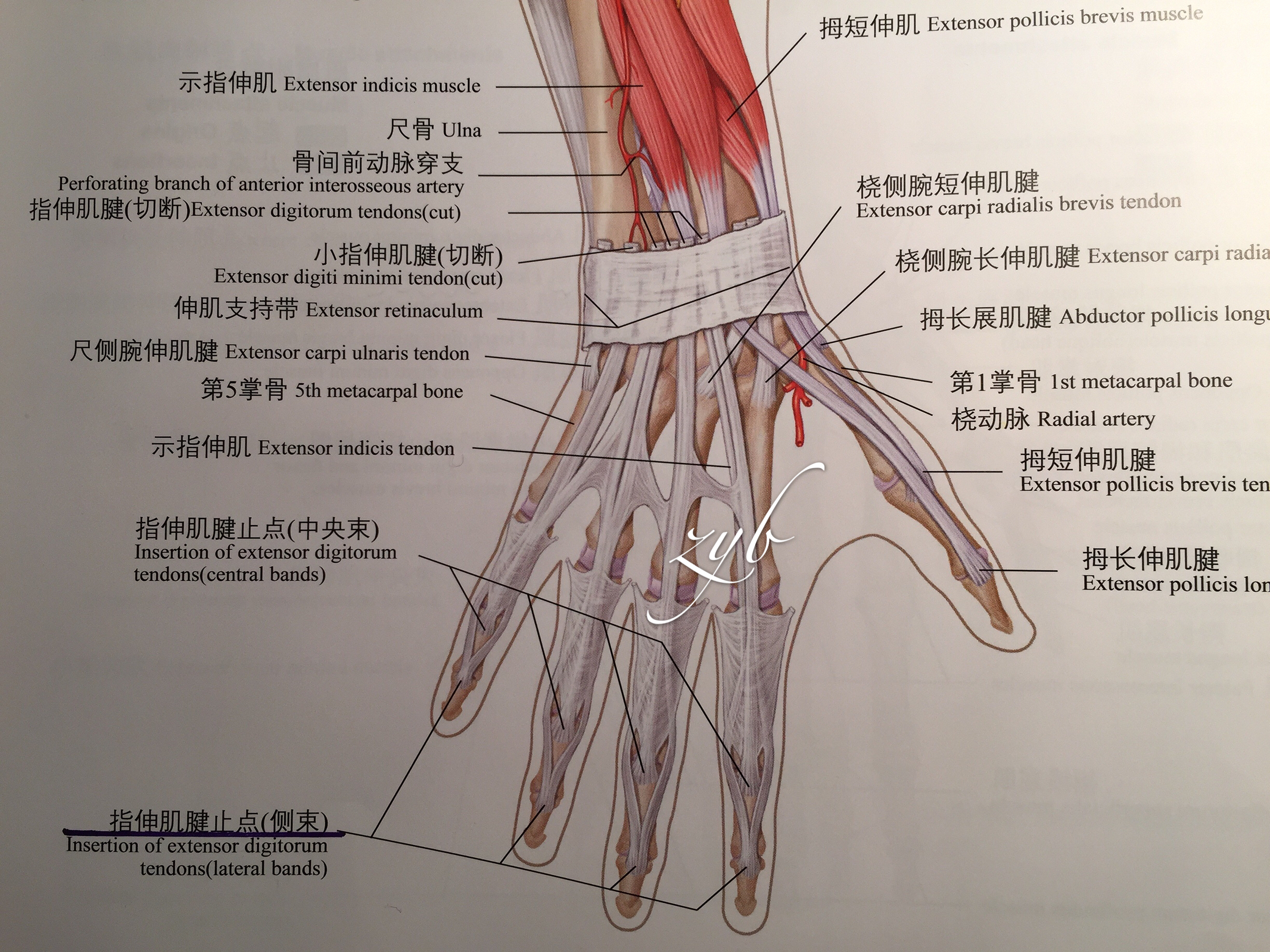 伸指肌腱解剖图片