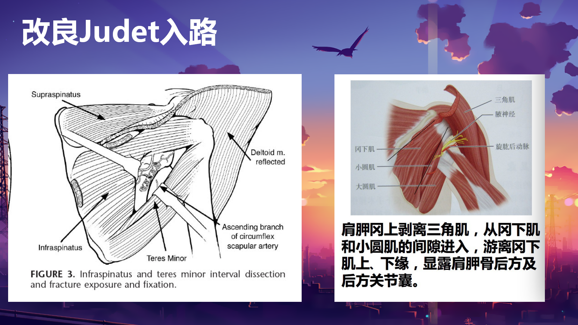 肩胛骨骨折外侧缘入路图片