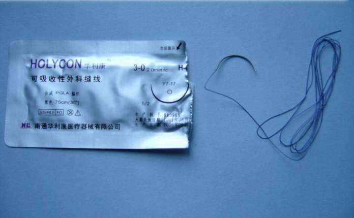 单股线怎么缝外科手术缝合线留在体内，会对人体有很大的影响吗？_https://www.jmylbn.com_新闻资讯_第2张