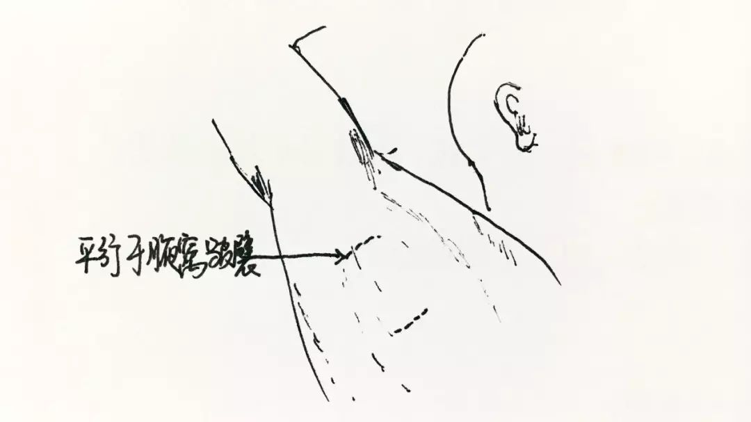 腋臭|夏季抗味儿大作战,清爽不留痕