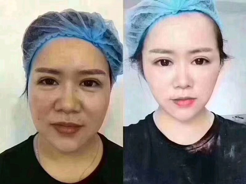 快手上卖的线雕效果好吗是真的吗