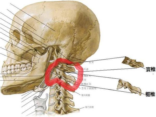 寰枢关节间隙图片图片