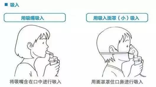 雾化治疗 到底是"法宝"还是"祸害"?