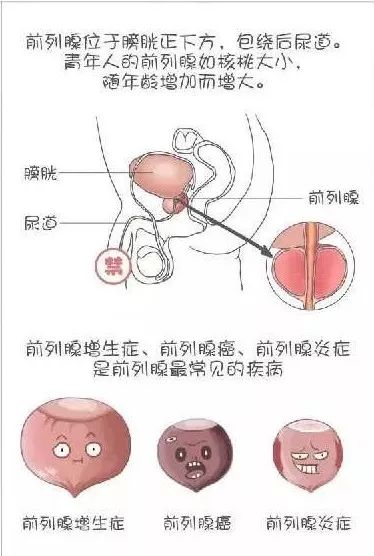 怎样找到自己的前列腺图片