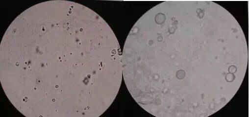 卵磷脂小体形态图片