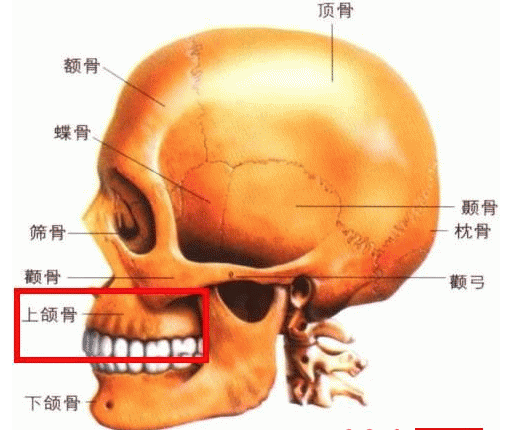 还会伴有骨骼的畸形,比如承载上前牙的上颌骨垂直向发育过度就会造成