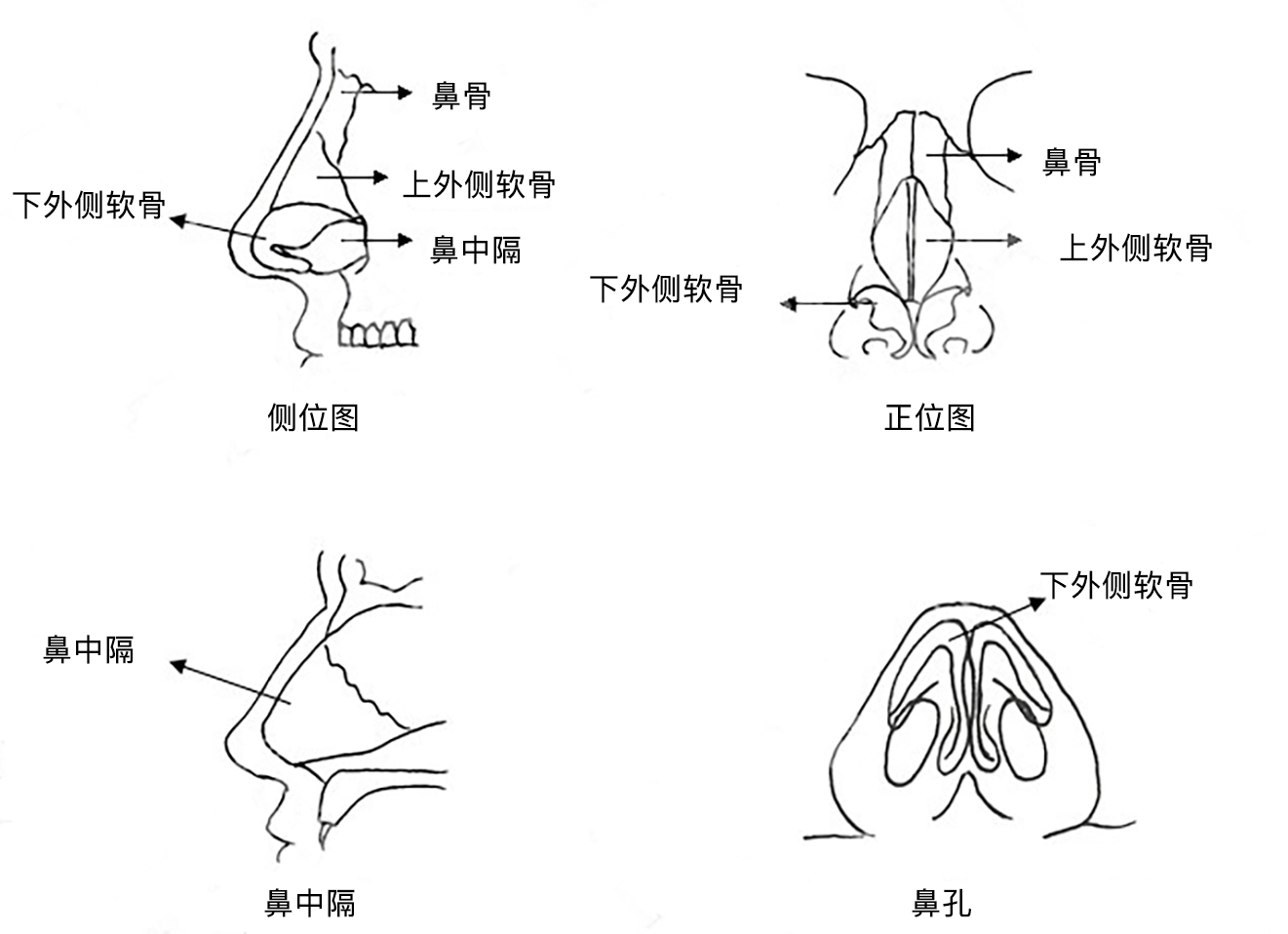 骨性鼻腔解剖图图片