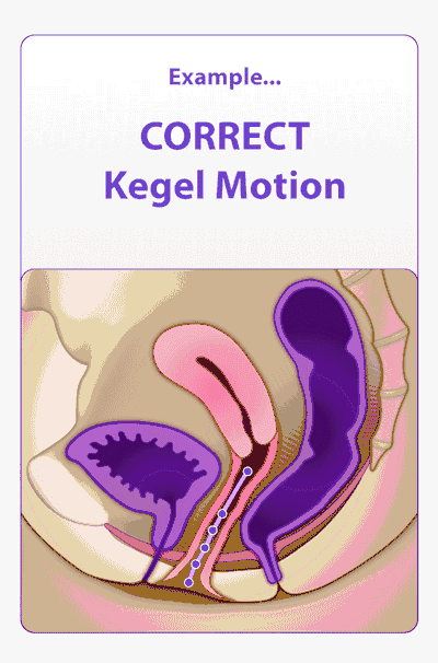 凯格尔运动是妹子的专属?男生练了好处也很多!