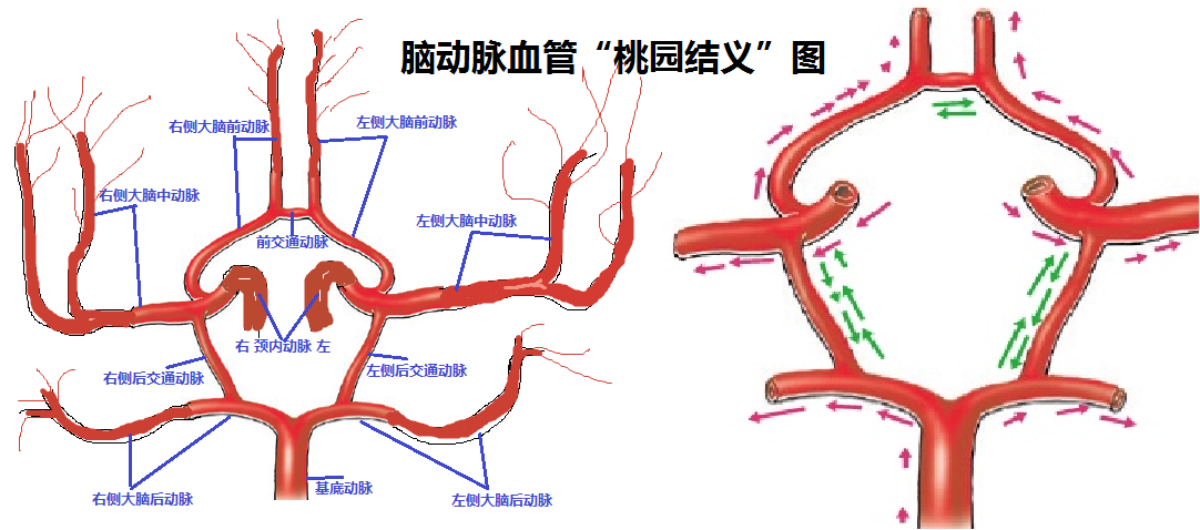 一般情况下通过这个血管环路大脑前,中,后动脉之间互通有无,万一那根