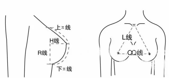 胸廓的宽窄决定了你能承受的假体大小,胸廓越大的妹子越能放大号的