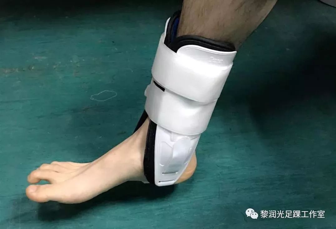 虽然足踝部做了相应的固定,但是患肢也是需要保持一定的活动,如髋关节