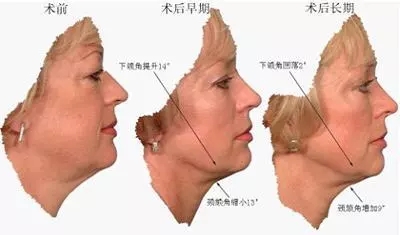 聊聊冻龄的那些事……_解芳_副主任医师_爱问健康