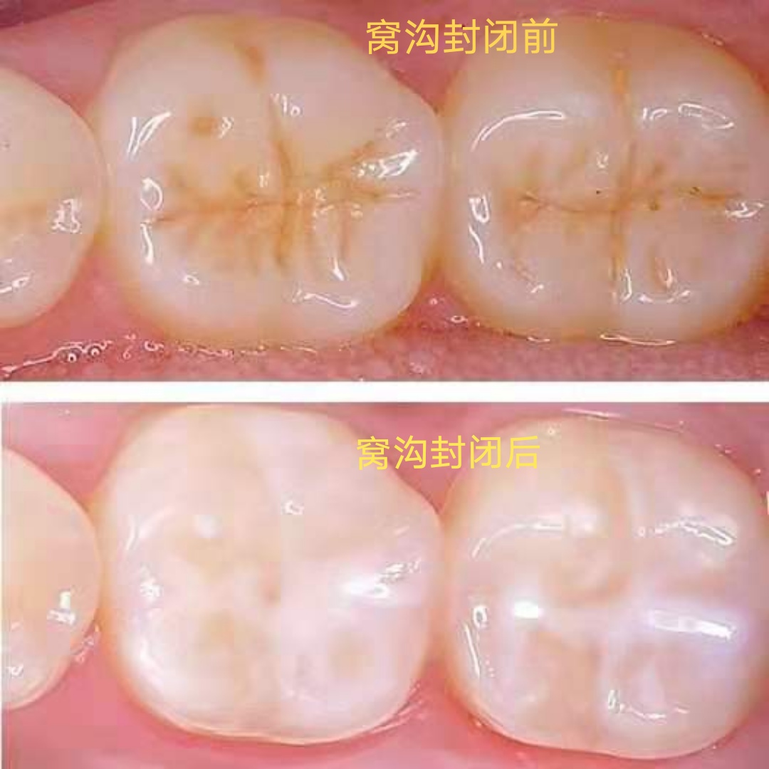 担心孩子到了诊所不愿意配合治疗?