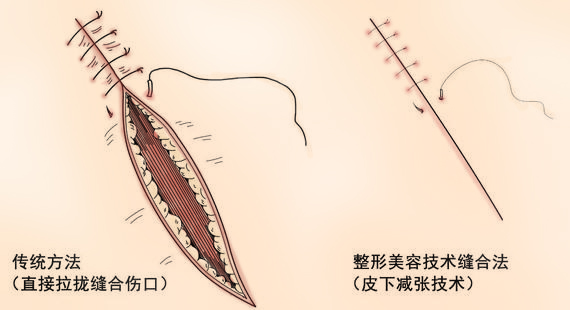 包茎伤疤恢复图图片