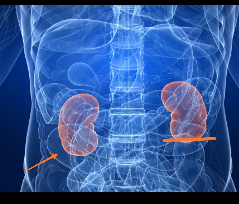 找不到原因,而你又是一个爱美减肥骨感的女士,要考虑到肾下垂的可能性