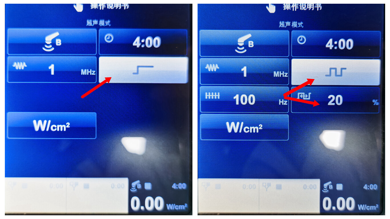 超声波治疗是什么“简单”解读超声波理疗_https://www.jmylbn.com_新闻资讯_第4张