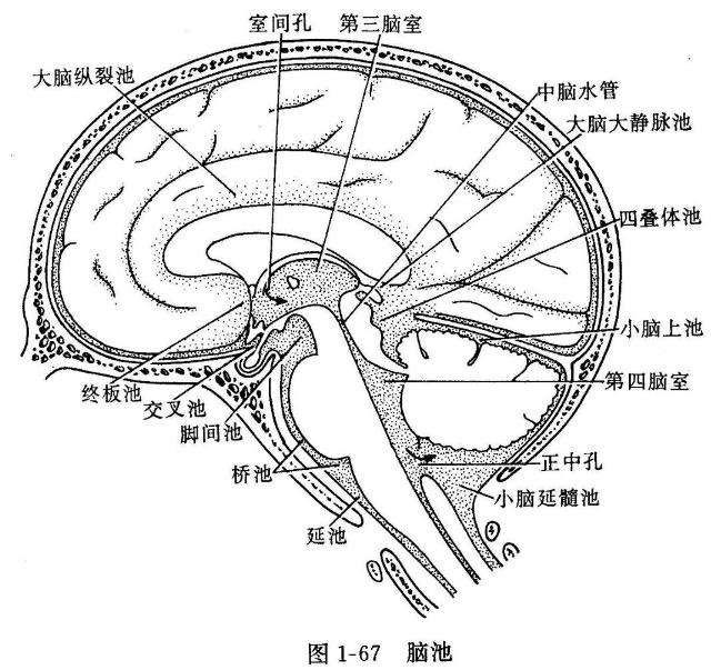 3,颅骨改变常见,ct及mri信号大多与脑脊液相同2,通常为偶然发现