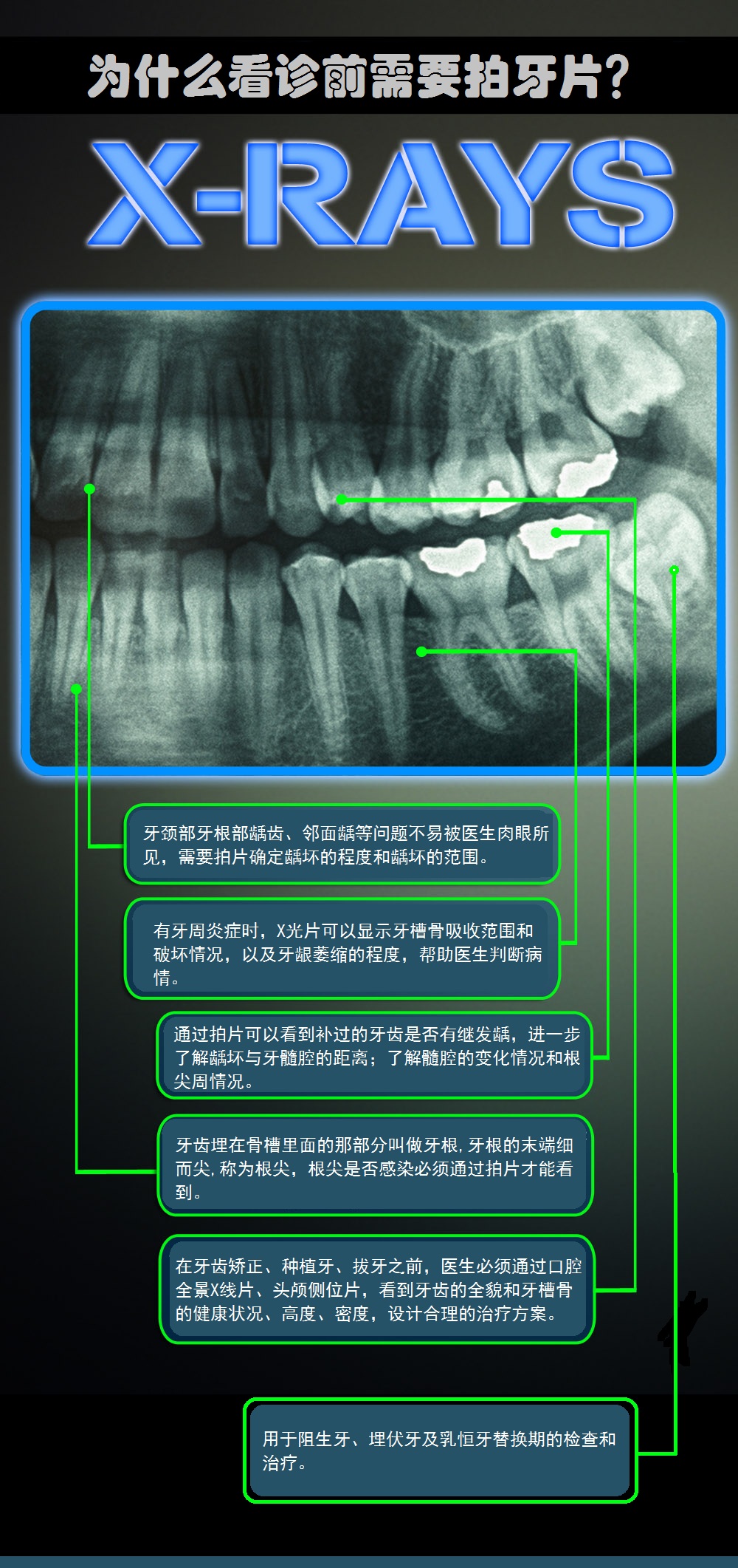 先放张图,让你们涨涨姿势,不拍片根本不知道你的牙齿长得会有多奇葩!