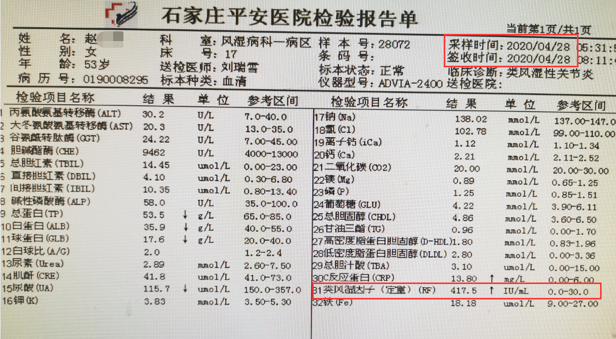 8年类风湿,类风湿因子一千多,关节肿痛,如何缓解?