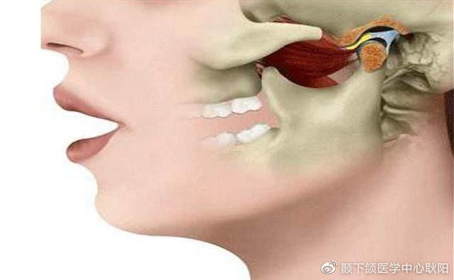 引起颞下颌关节弹响的原因有哪些