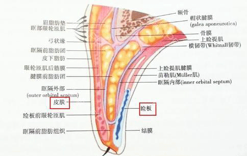 上眼睑解剖示意图.jgp.gif