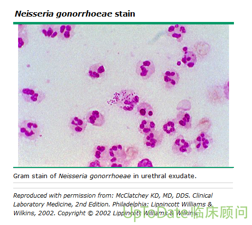 淋球菌革兰染色绘图图片