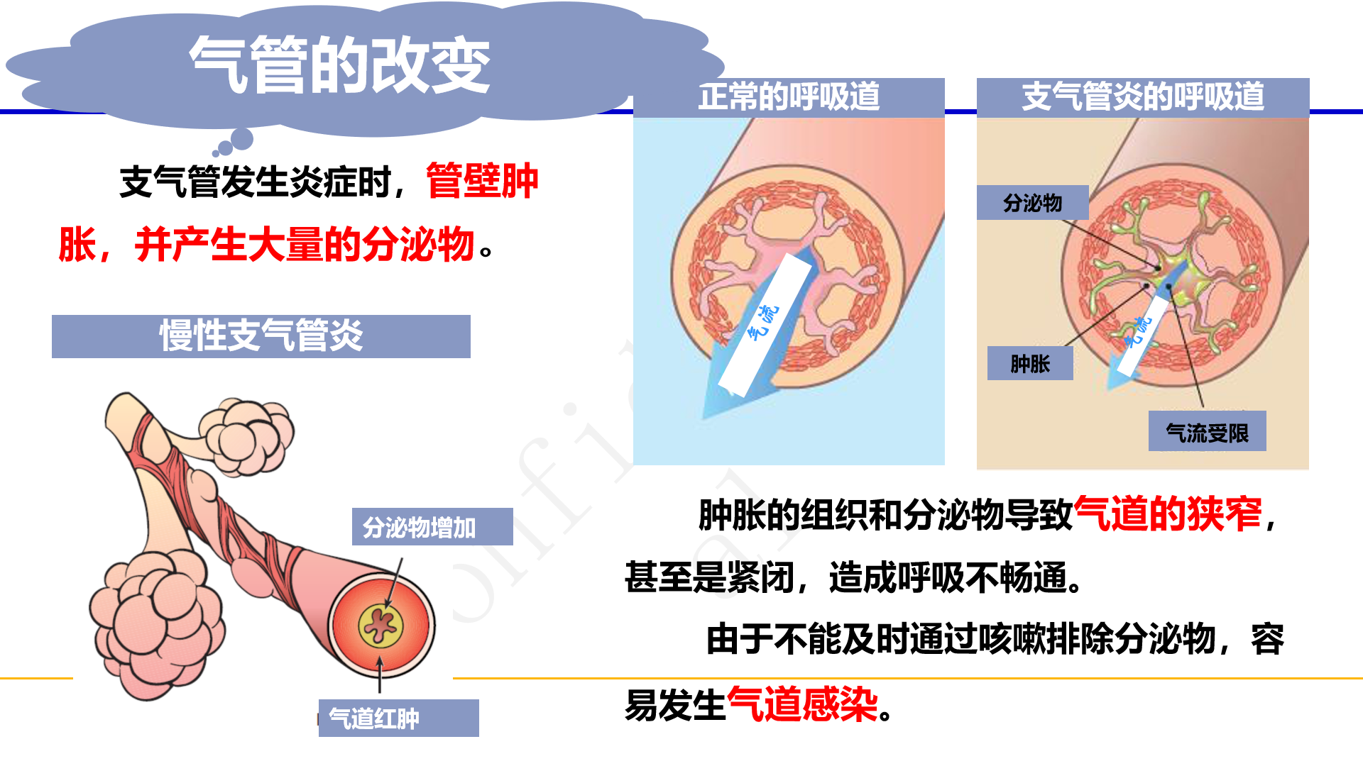 慢性阻塞性肺疾病(简称慢阻肺):是一种可预防和可治疗的常见疾病