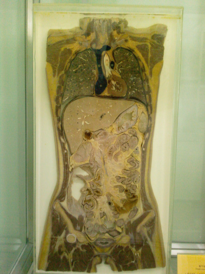 人体解剖标本实体图片