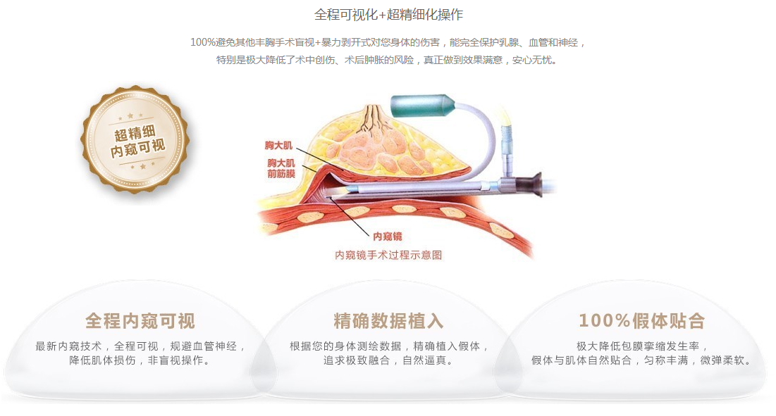 丰胸变大内窥镜手术图片