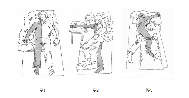 偏瘫患者正确的睡觉姿势