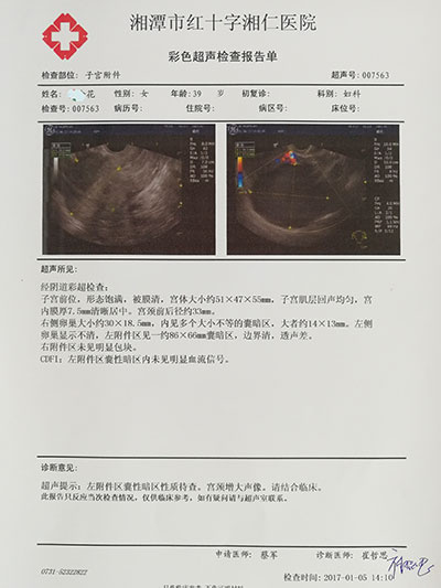 子宫内膜异位症:根治的最佳办法是生孩子!